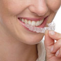 Invisalign