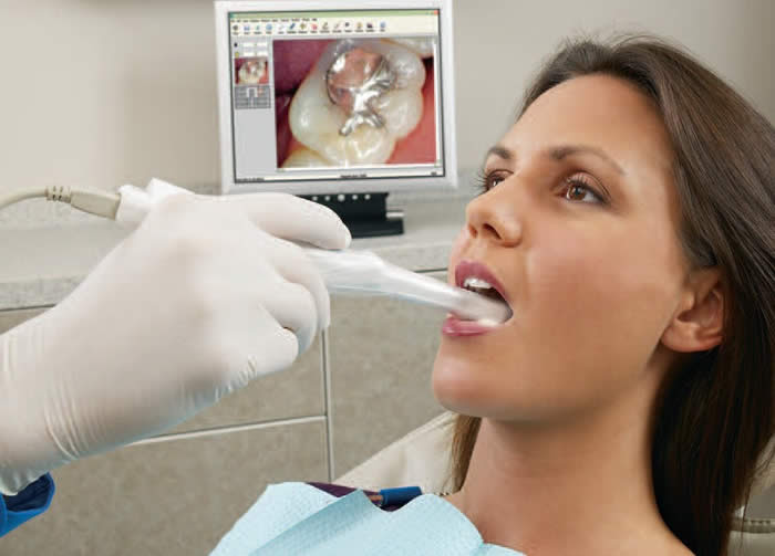 intraoral cameras