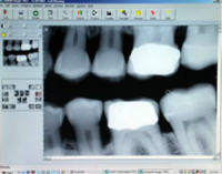 Digital X Rays