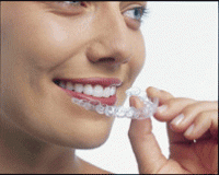 Invisalign